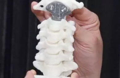 3D打印人工椎體注冊技術審查指導原則（2020年第36號）(圖1)